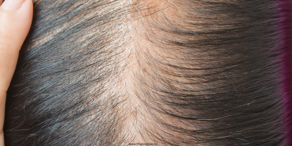 Thinning Hair? Why and products Worth Trying