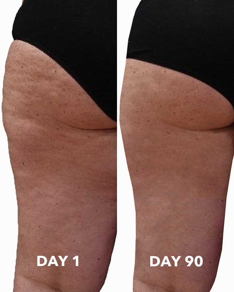 anti cellulite body oil