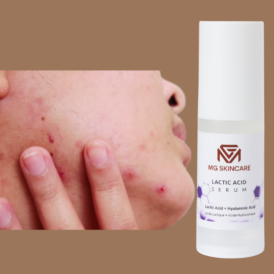 LACTIC ACID SERUM