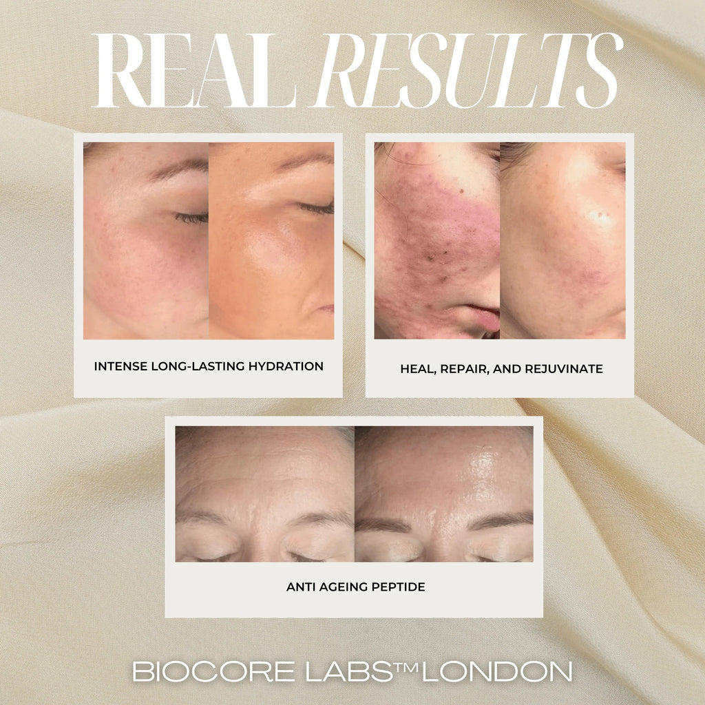 face serum  -  HIGH strength Snail Mucin, Acetyl Hexapeptide-8, and Hyaluronic Acid together in one bottle! 